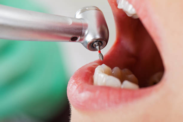 Best Chipped Tooth Repair Near Me  in Chaparral, NM